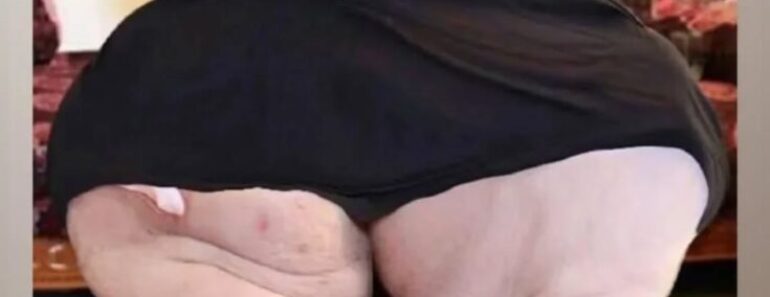 The world’s heaviest woman, who consumed a lot of milkshakes and weighed fifty stone, is no longer recognizable.